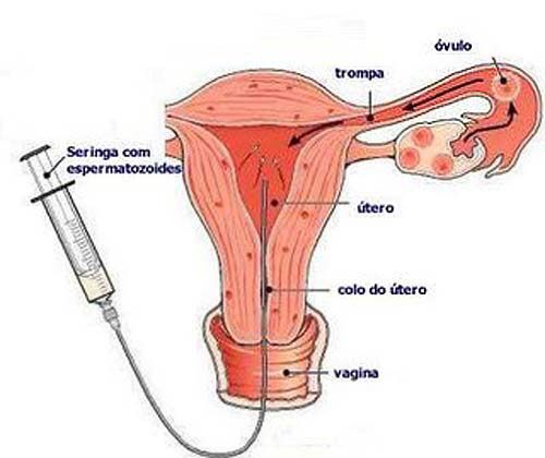 FERTILIZAÇÃO
