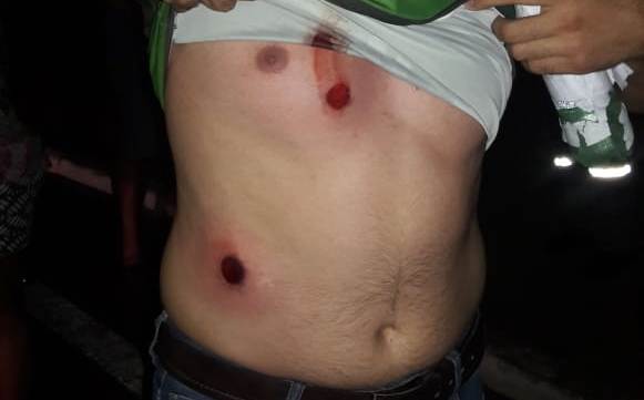 caminhoneiro bala de borracha 