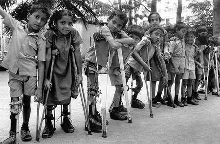 Polio