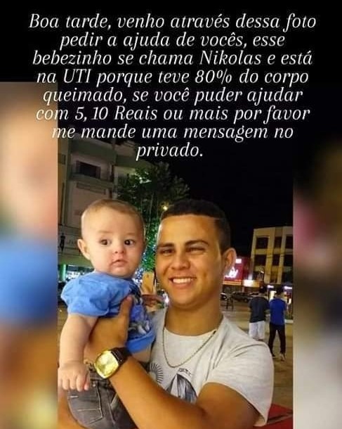 Beb� - Nikolas tem corpo queimado ap�s explos�o de fog�o em Tangar�
