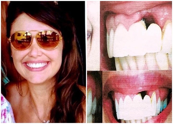 bartira dentista denise