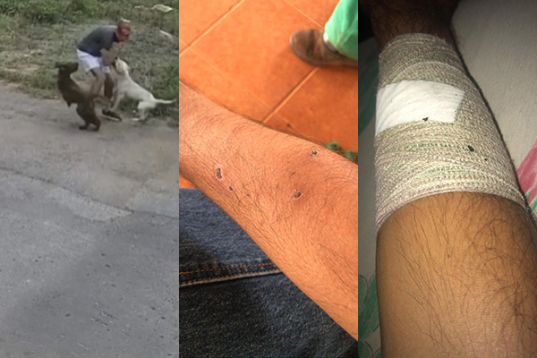 Ataque de Pitbull em V&iuml;&iquest;&frac12;rzea Grande - Kevin Maier