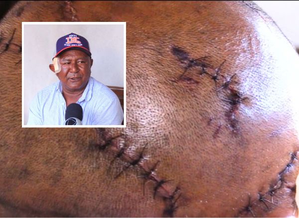 indigena atacado por on�a