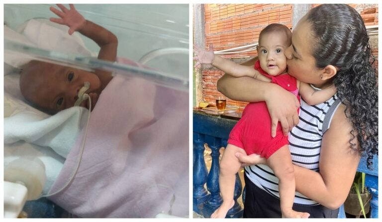 Beb� que nasceu com 535g em Cuiab� faz um ano de vida
