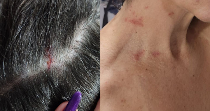 servidora al agressao mulher PM