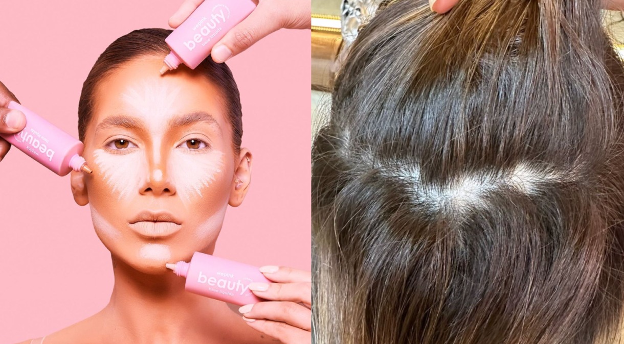 virginia - queda - cabelo