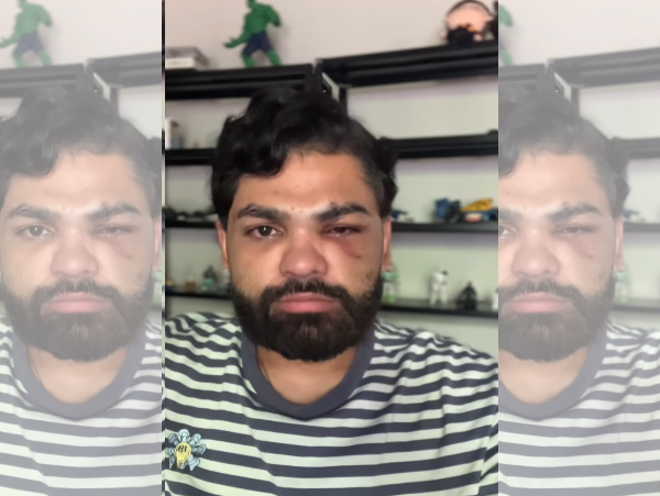 Douglas Amorim agress�o boate Nuun Garden