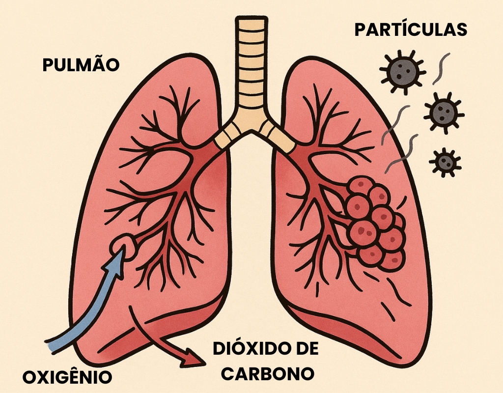 Pulm&iuml;&iquest;&frac12;o, qualidade do ar, part&iuml;&iquest;&frac12;culas