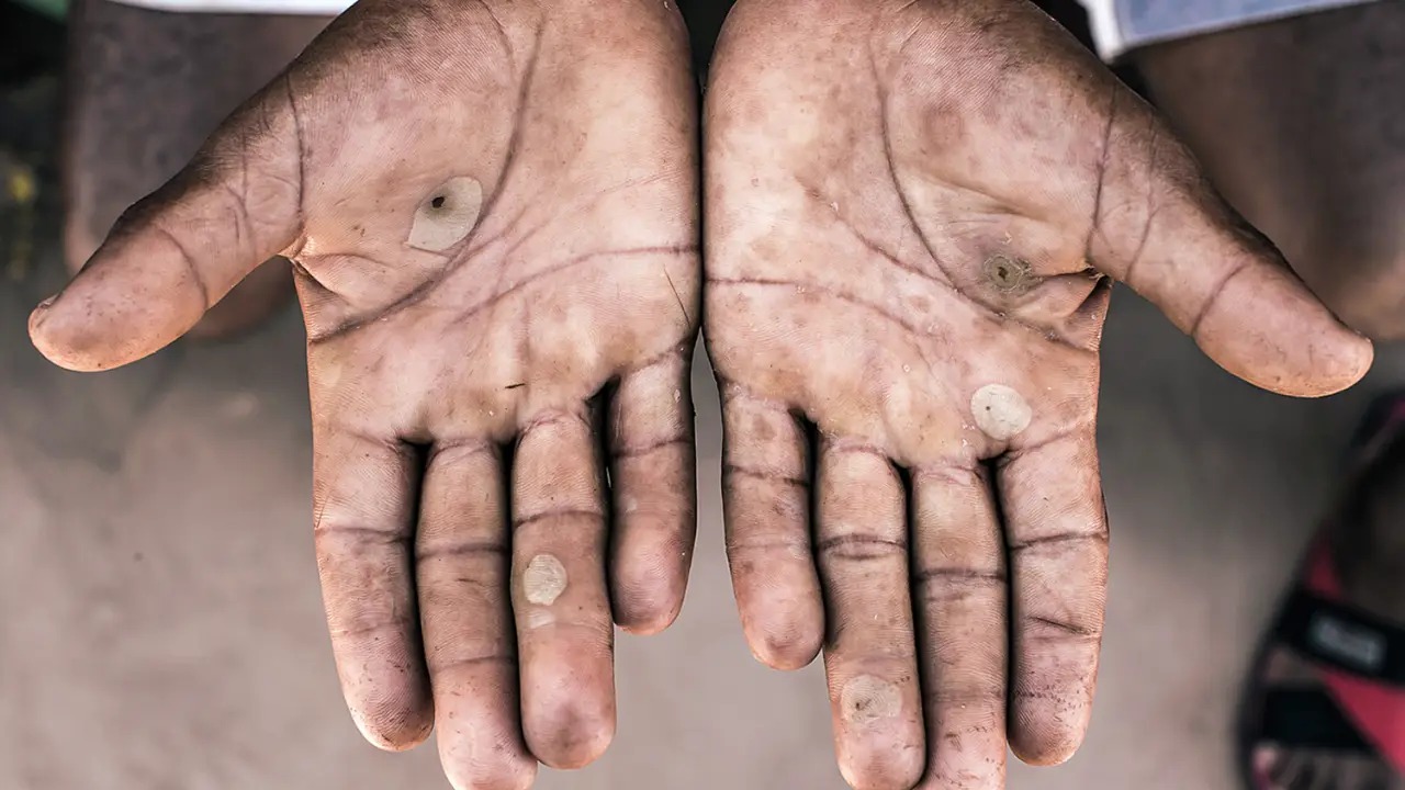 M�O DE PESSOA RESGATADA/ TRABALHO ESCRAVO