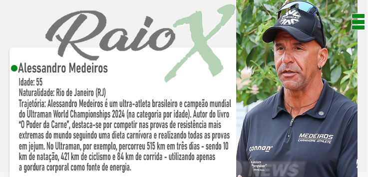 RAIO - X foto - Alessandro Medeiros